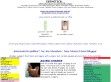 Labioplasty after pregnancy - http://www.e-sthetics.com/GENITAL/labioplasty.html