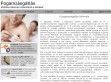 Fogamzásgátlás szoptatáskor - http://fogamzasgatlas.repeta.hu/szoptataskor