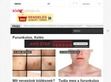 Furunkulusok vagy kelések ellen - http://furunkulus-keles.borgyogyulas.com/