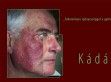 Intim szőrtelenítés - http://kadardr.hu/szortelenites.htm